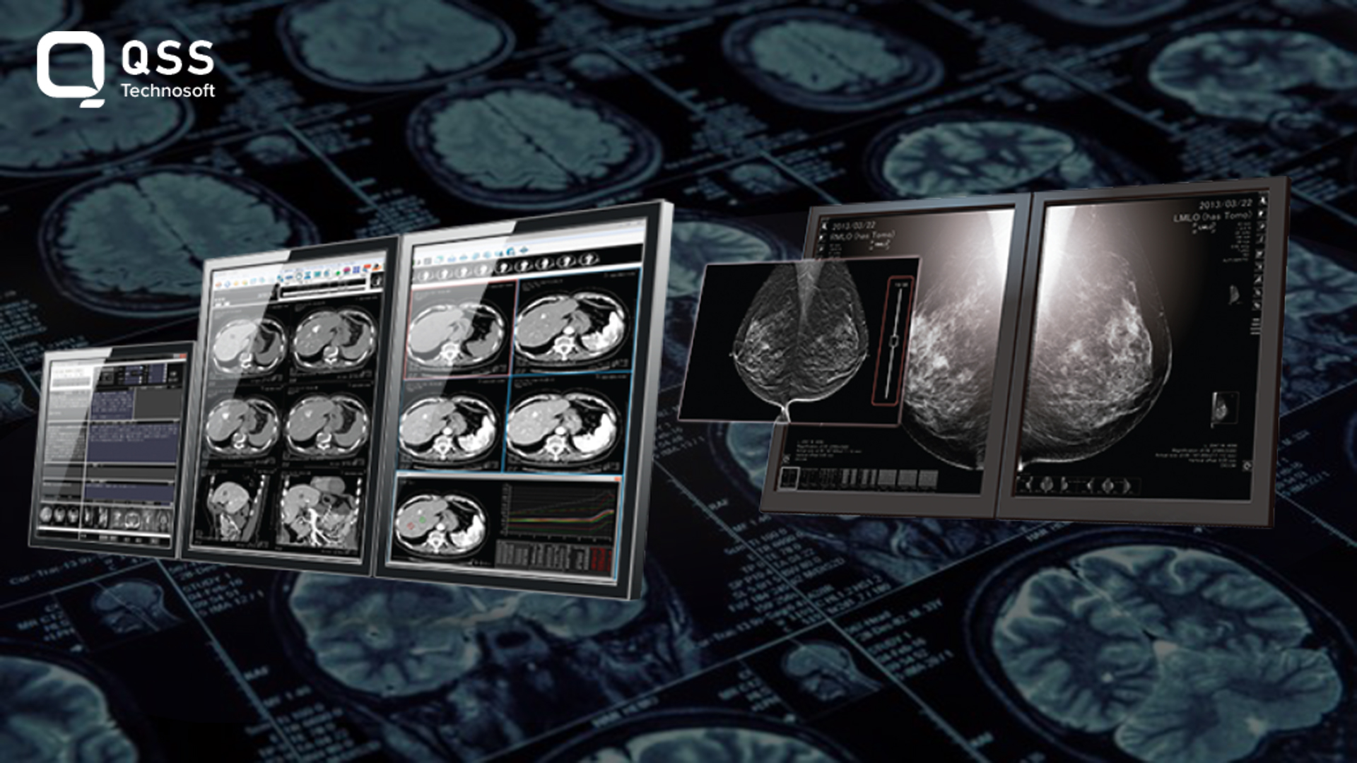 Benefits and Downsides of Migrating from an Older PACS to a Newer DICOM-Compliant System